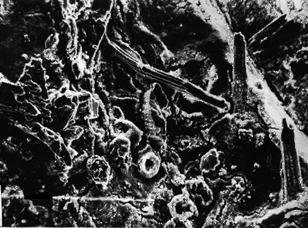 phosphatized electron micrograph